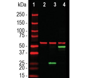 SARS-CoV-2 S-Protein ACE2 Binding Domain Antibody