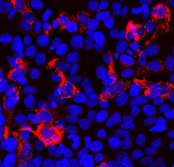 SARS-CoV-2 S-Protein ACE2 Binding Domain Antibody