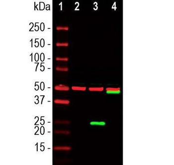 SARS-CoV-2 S-Protein ACE2 Binding Domain Antibody