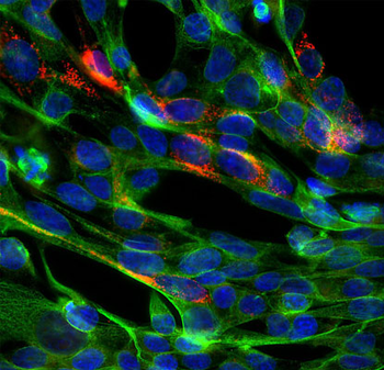 SARS-CoV-2 S-Protein ACE2 Binding Domain Antibody