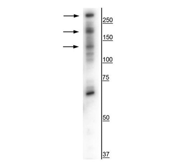 CaSR Antibody