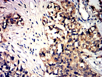 IL1B interleukin 1 beta Antibody