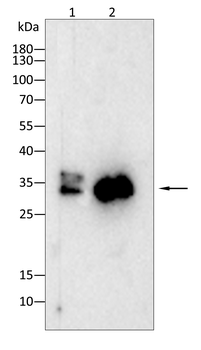 IL1B interleukin 1 beta Antibody