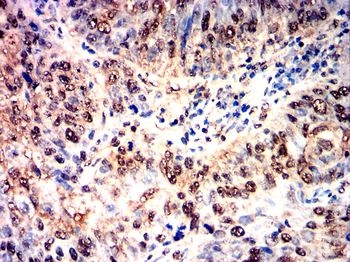 PPARGC1A Antibody