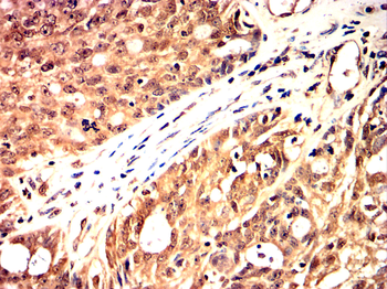 PPARGC1A Antibody