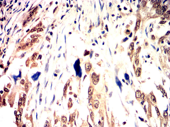 MYC Antibody