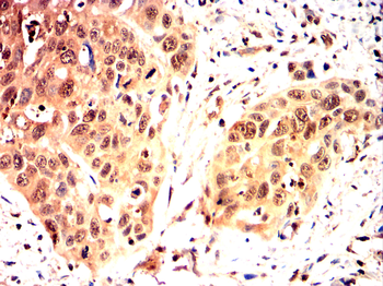 MYC Antibody