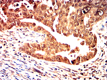 MYC Antibody