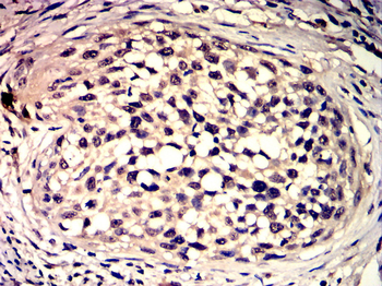 PPARA Antibody