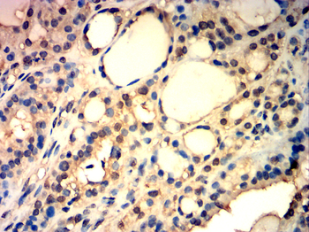 PPARA Antibody