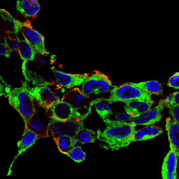 Claudin 1 Rabbit Polyclonal Antibody