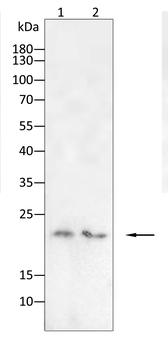 Claudin 1 Rabbit Polyclonal Antibody