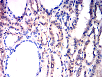 JAK1 Antibody