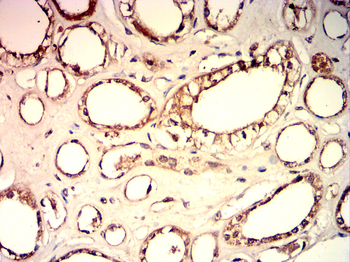 RPS6KB1 Antibody