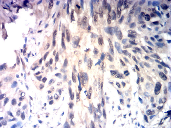 ESR2 Antibody