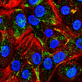 GSDMD Antibody