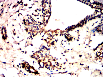 MMP9 Antibody