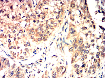 LAMP1 Antibody