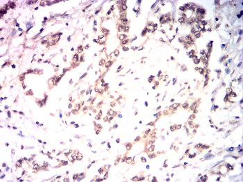 GSDME Antibody