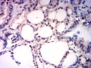 GSDME Antibody