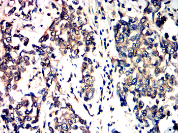 FGFR3 Antibody