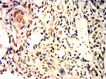 IL5 Antibody
