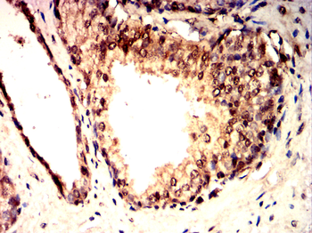 IL5 Antibody