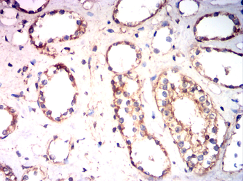 PDGFRB Antibody