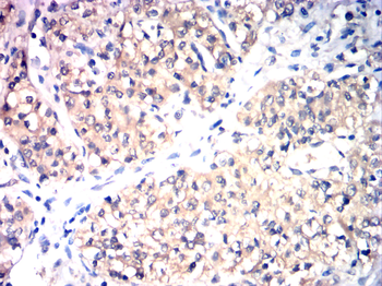 FGFR1 Antibody