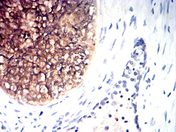 CASP1 Antibody