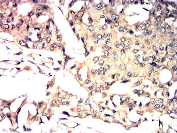 MTOR Antibody