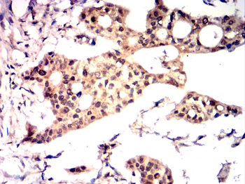 CEBPB Antibody
