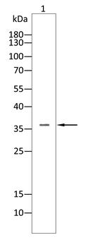 CEBPB Antibody