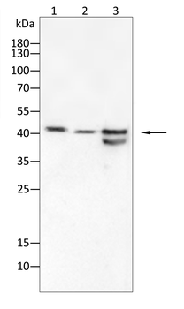 CEBPB Antibody