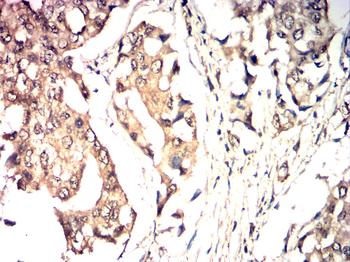 TRIM21 Antibody