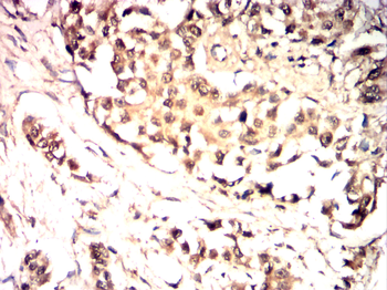 TRIM21 Antibody