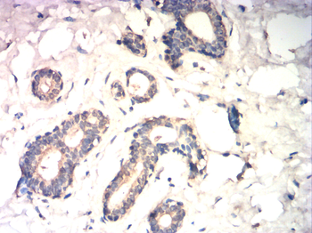 EIF5A Antibody