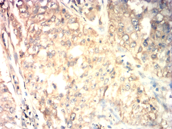 EIF5A Antibody