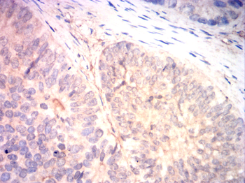 JUP Antibody