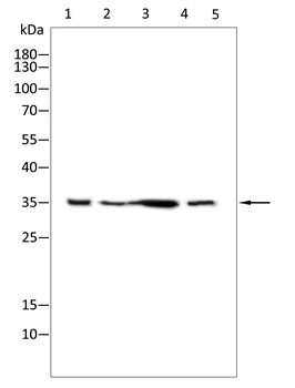 AQP4 Antibody
