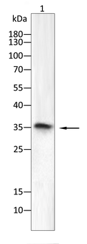 AQP4 Antibody
