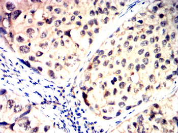 BAK1 Antibody