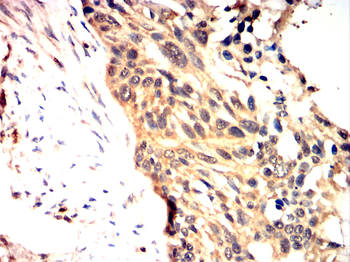 Catenin alpha-1 Antibody