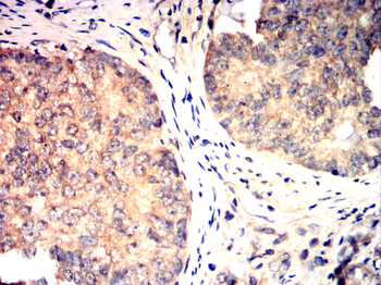 Catenin alpha-1 Antibody