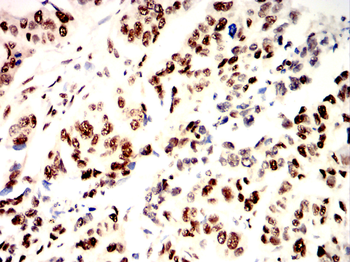 XRCC6 Antibody