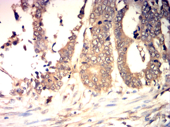 CDKN2B Antibody