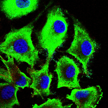 CD14 Antibody