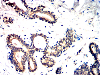 CD14 Antibody