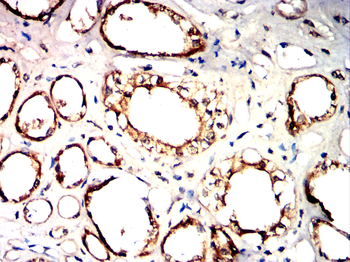 CD14 Antibody
