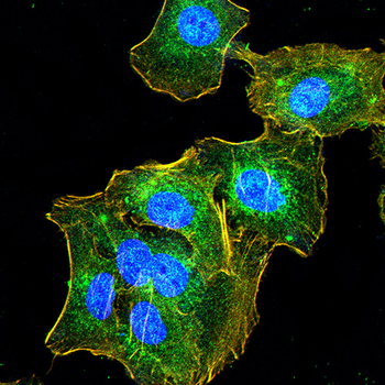 IL31 Antibody